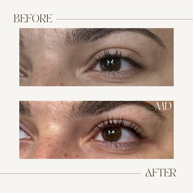 Images Wilkes Rejuvenation MD