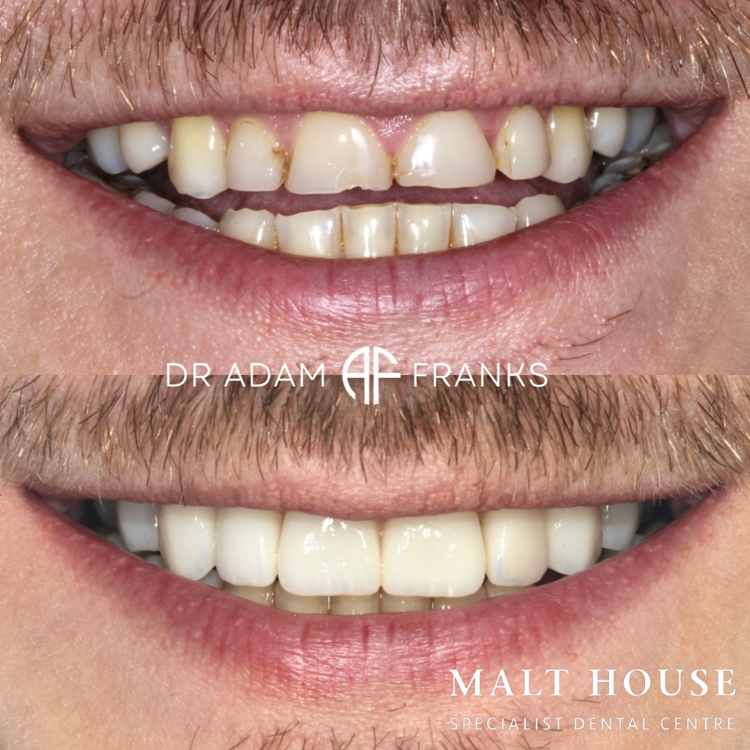 Images Malt House Specialist Dental Centre