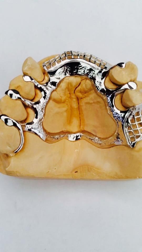 Images Chrome Cast Dental Laboratory