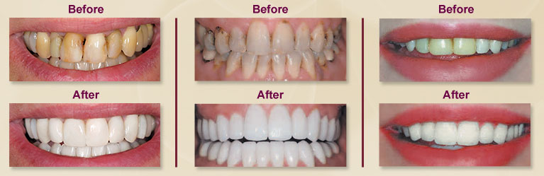 Images Lifetime Family Dentistry