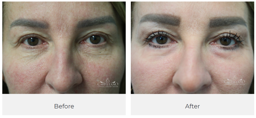 Castellano Cosmetic Surgery Center Image