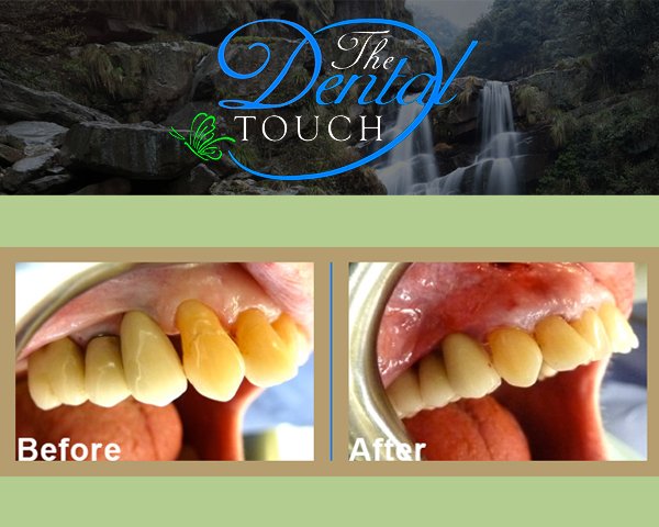 Images The Dental Touch Oakland