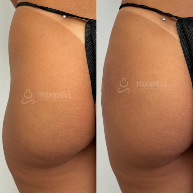 Images Toxwell Med Spa and Wellness