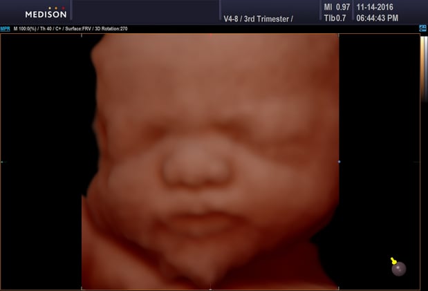 Images Heavenly 3D 4D Ultrasounds