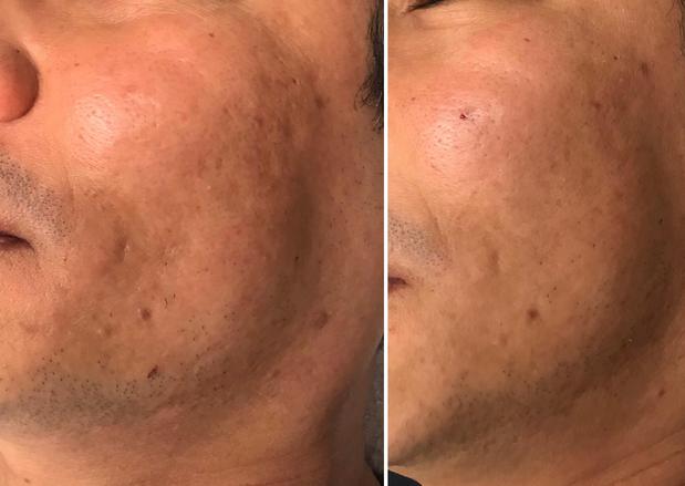 Images RAREV Med Spa