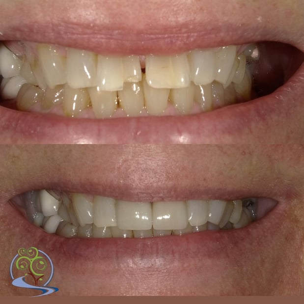 Images Reimels Family & Cosmetic Dentistry