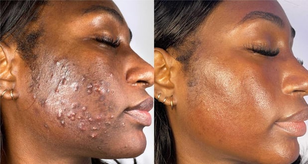 Images Face of Jules