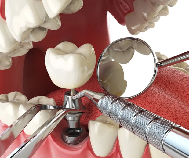 Images Silver State Dental