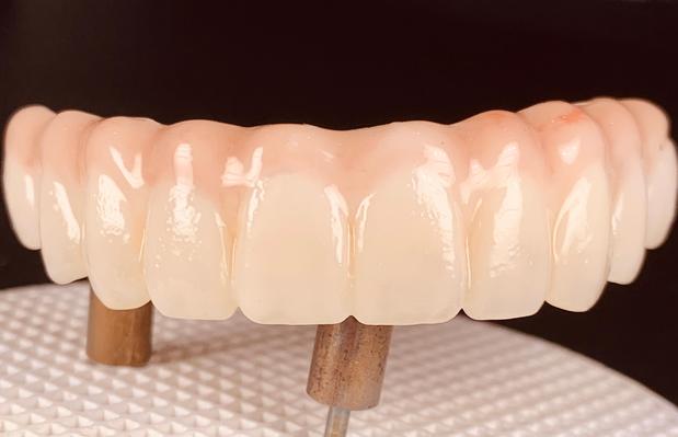Images South Shreveport Dental