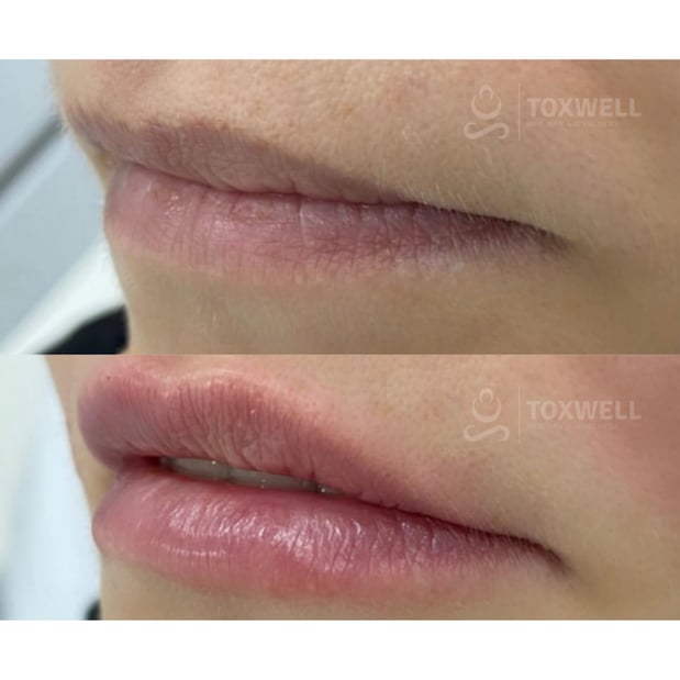 Images Toxwell Med Spa and Wellness