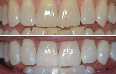 Images My Dentist Dott.ssa Maria Elena Pepe