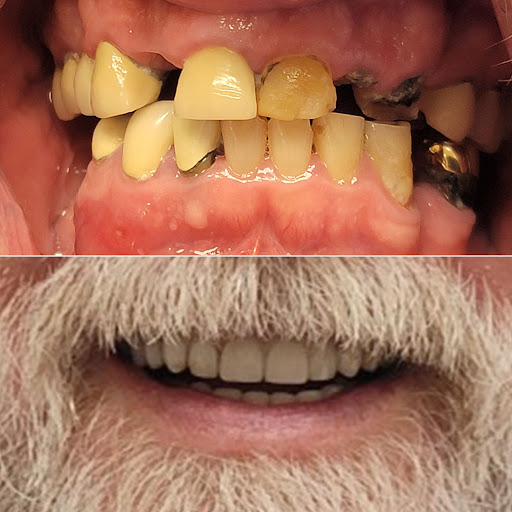 Images Advanced Dentistry & Implant Center