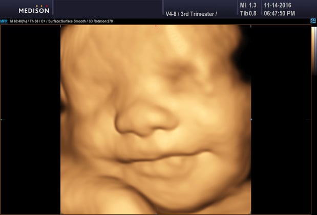 Images Heavenly 3D 4D Ultrasounds