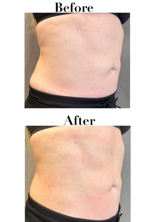 Images Sunkissed Med Spa