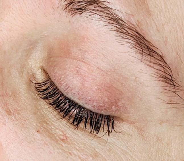 PHIVU, Oberstrasse 175 in St. Gallen