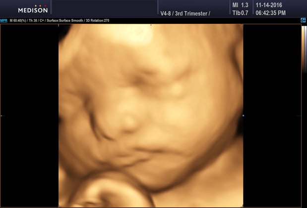 Images Heavenly 3D 4D Ultrasounds