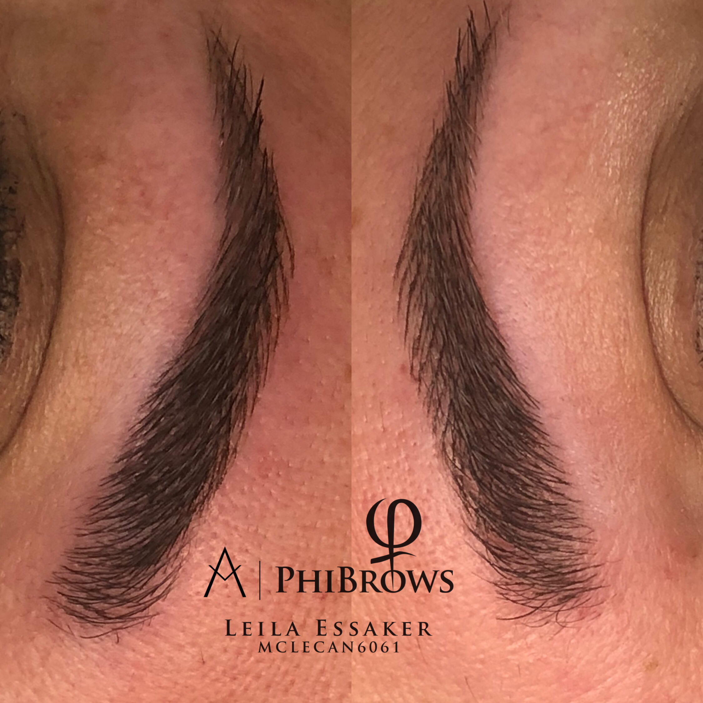 Images Clinique d'Esthétique Leila - Hydrafacial, Microblading, Épilation Laser Sainte-Foy