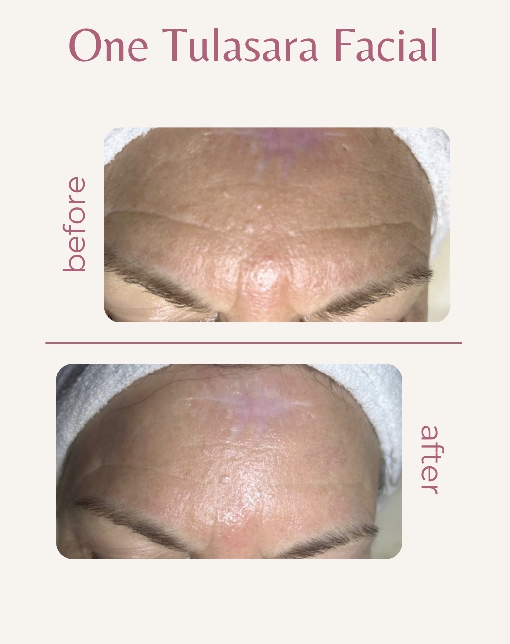 One Tulasara Facial
By Dana