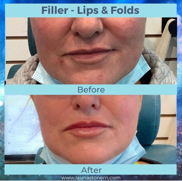 Images Launa Stone, R.N.