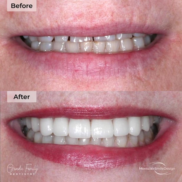 Images Orinda Family Dentistry