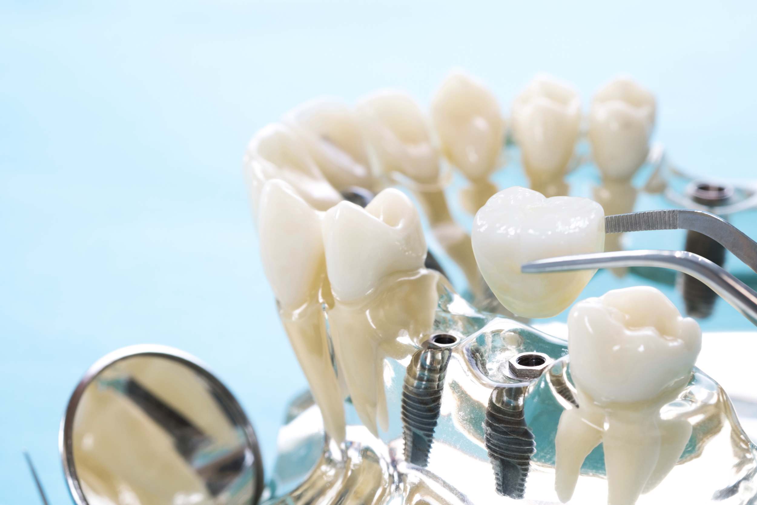 Bilder Linder Pro-Dental GmbH