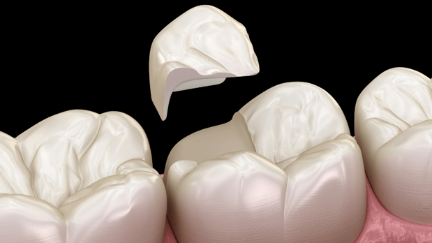 Images Harborside Dental Team