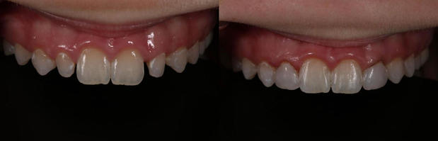 Images Verde Pointe Dental Associates