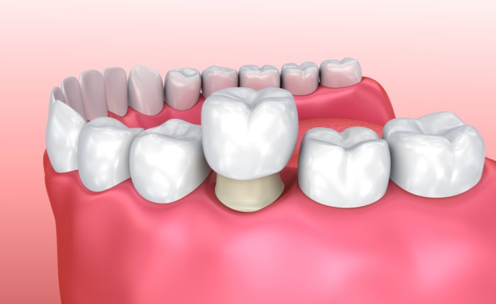 Images Clinique Dentaire Dr. Karam - Dentiste, Blanchiment Dentaire Ahuntsic