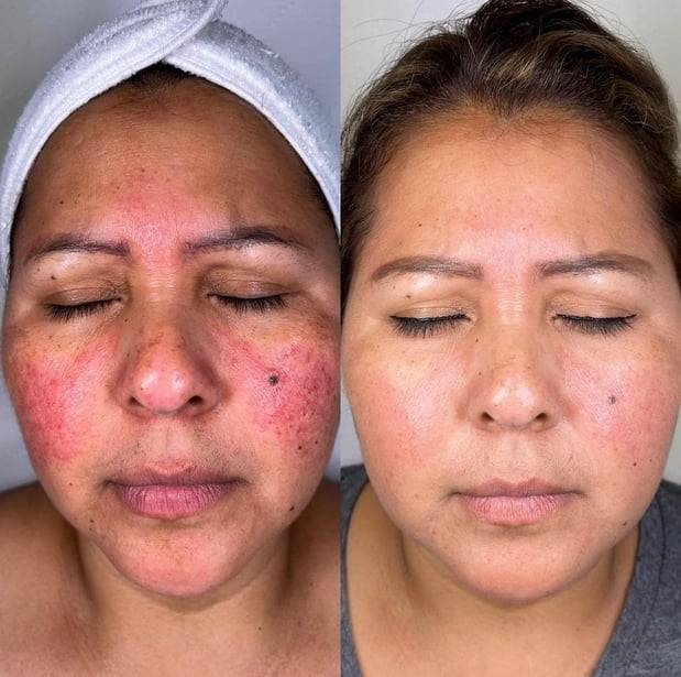 Images Face of Jules