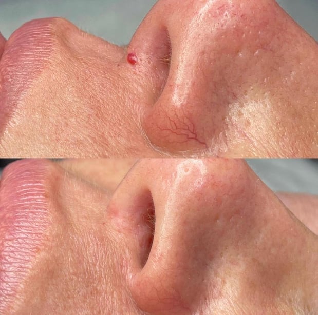 Images Face of Jules