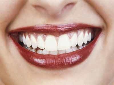 Images Studio Dentistico Buttignol Dr. Giovanni
