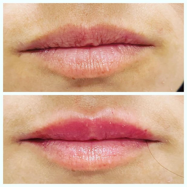 Images Renew Body Contouring & MedSpa