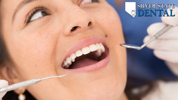 Images Silver State Dental