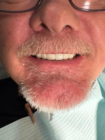 Images Value Dental Care
