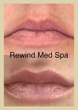 Images Rewind Med Spa