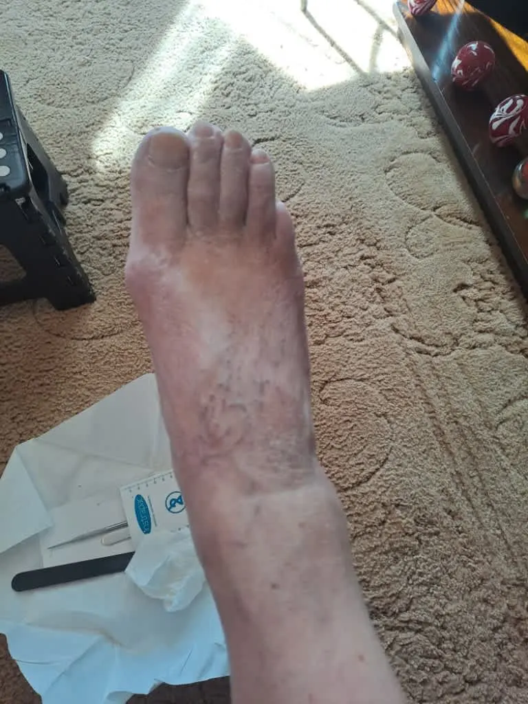 Images Foot Soldiers Podiatry