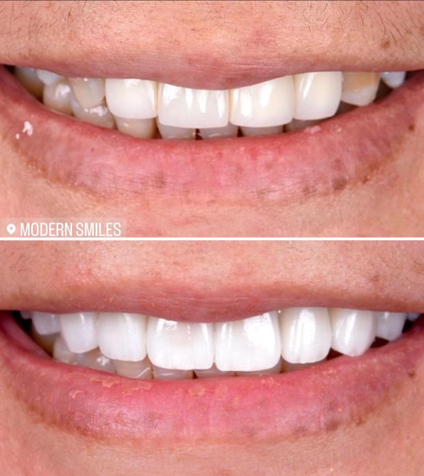 Images Modern Smiles