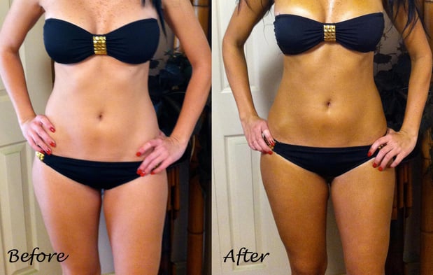 Images Craze For Rayz Tanning Salon & Mini Spa
