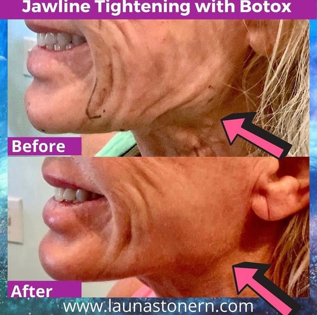 Images Launa Stone, R.N.