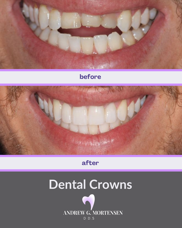 Images Andrew G. Mortensen, DDS