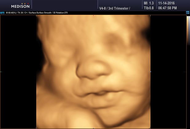 Images Heavenly 3D 4D Ultrasounds