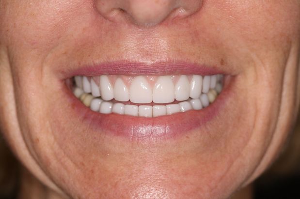 Images Aaron A. Leishman DMD, PA