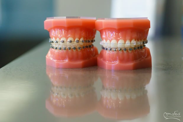 Images Signature Orthodontics