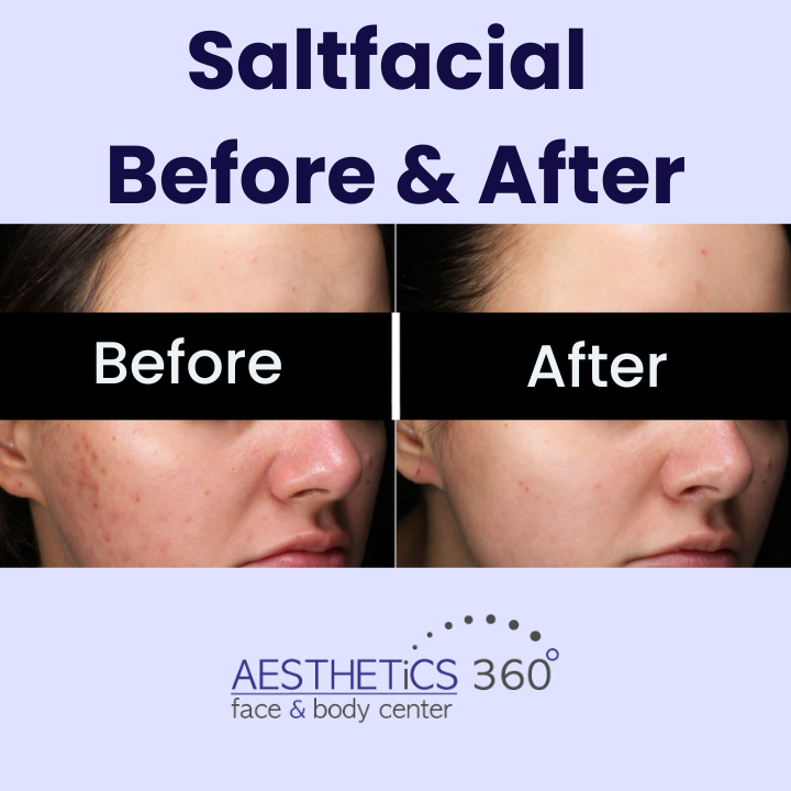 Images AESTHETICS 360° Face & Body Center
