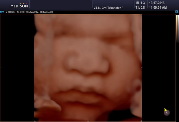 Images Heavenly 3D 4D Ultrasounds