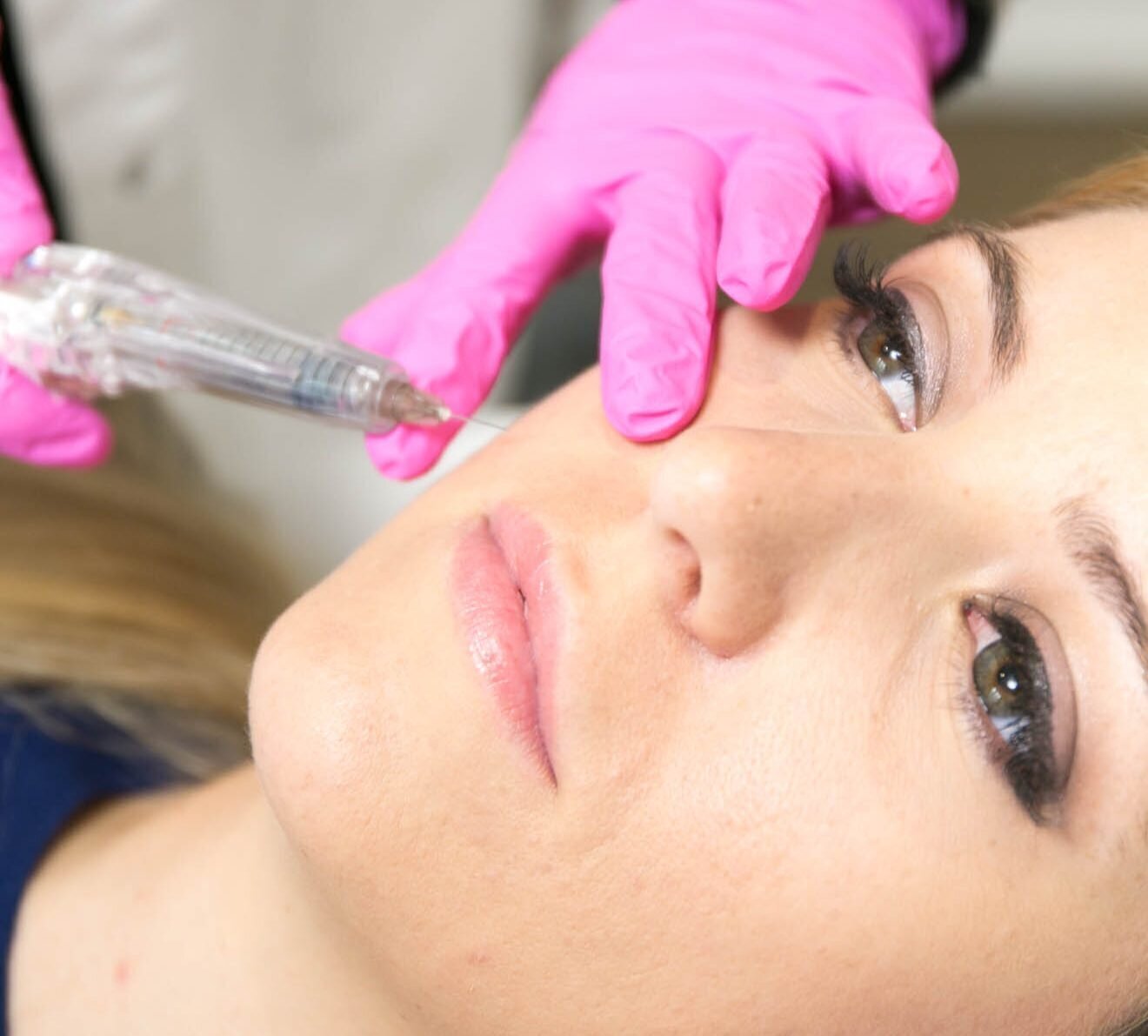 Bilder Hautzart Frankfurt – Hautverjüngung & Ästhetische Medizin