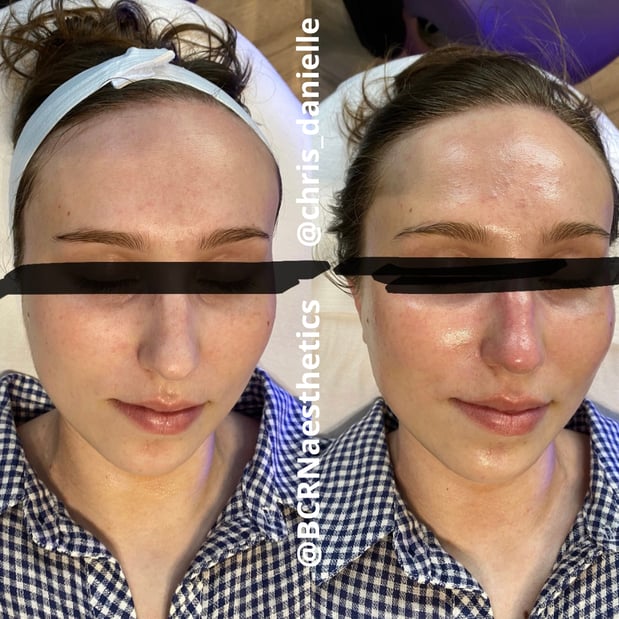 Images BCRN Aesthetics MedSpa