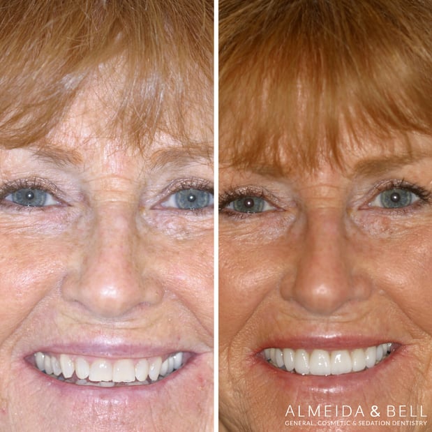Images Almeida & Bell Dental Lone Tree - General, Cosmetic, and Implant Dentistry