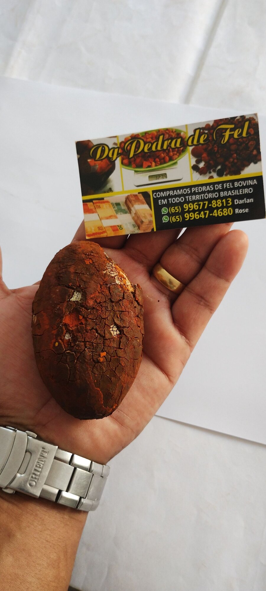 Images Dg pedras de fel bovinos