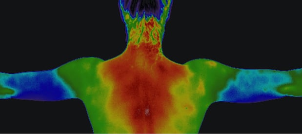 Images Choice Thermography LLC